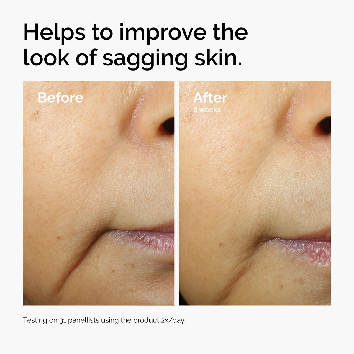 caffeine-3-escin-1-face-serum-h2 ord-caffeine-3pct-escin-1pct-face-serum-before-after-sagging.jpg