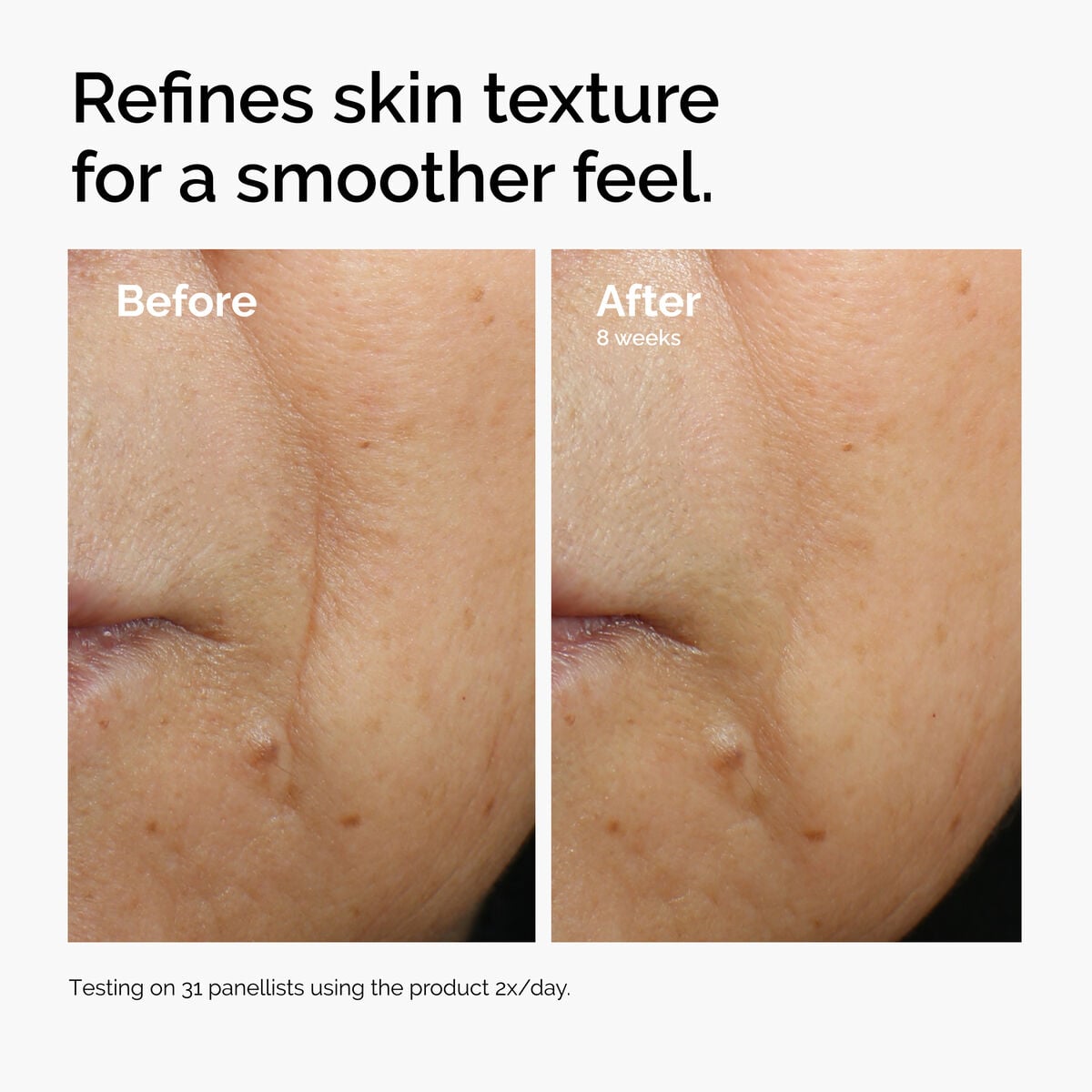 caffeine-3-escin-1-face-serum-h2 ord-caffeine-3pct-escin-1pct-face-serum-before-after-texture.jpg