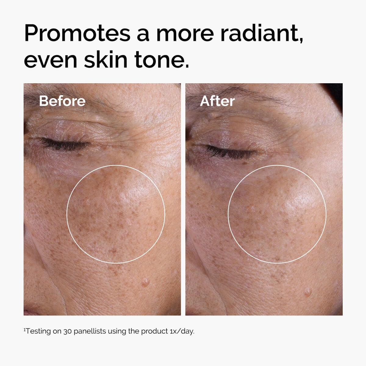 glycolic-acid-7-exfoliating-toner-q6 ord-glycolic-before-after-radiance.jpg