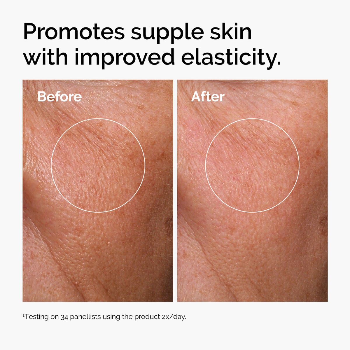 hyaluronic-acid-2-b5-with-ceramides-k5 ord-hyaluronic-acid-2pct-b5-hydrating-serum-before-after-elasticity.jpg