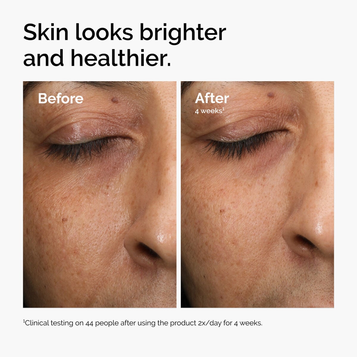 multi-antioxidant-radiance-serum-d8 ord-mars-before-after-healthy.jpg