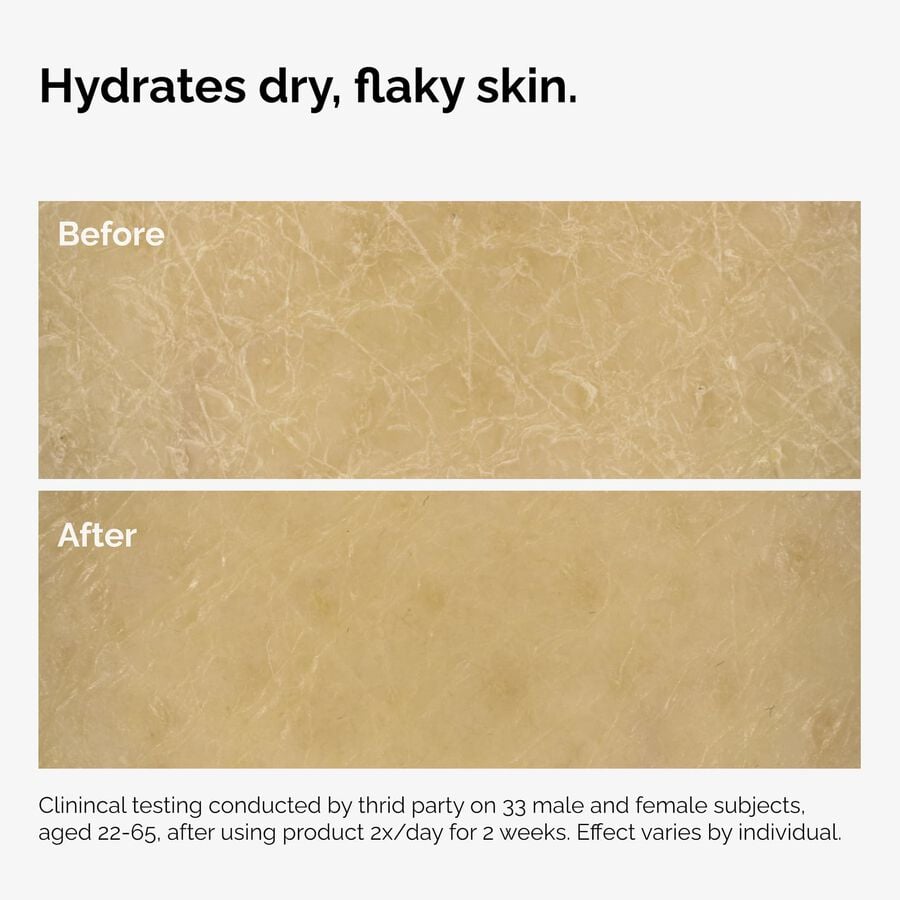 the-body-care-collection-r7 ord-natural-moisturizing-factors-inulin-body-before-after-graphic-02.jpg