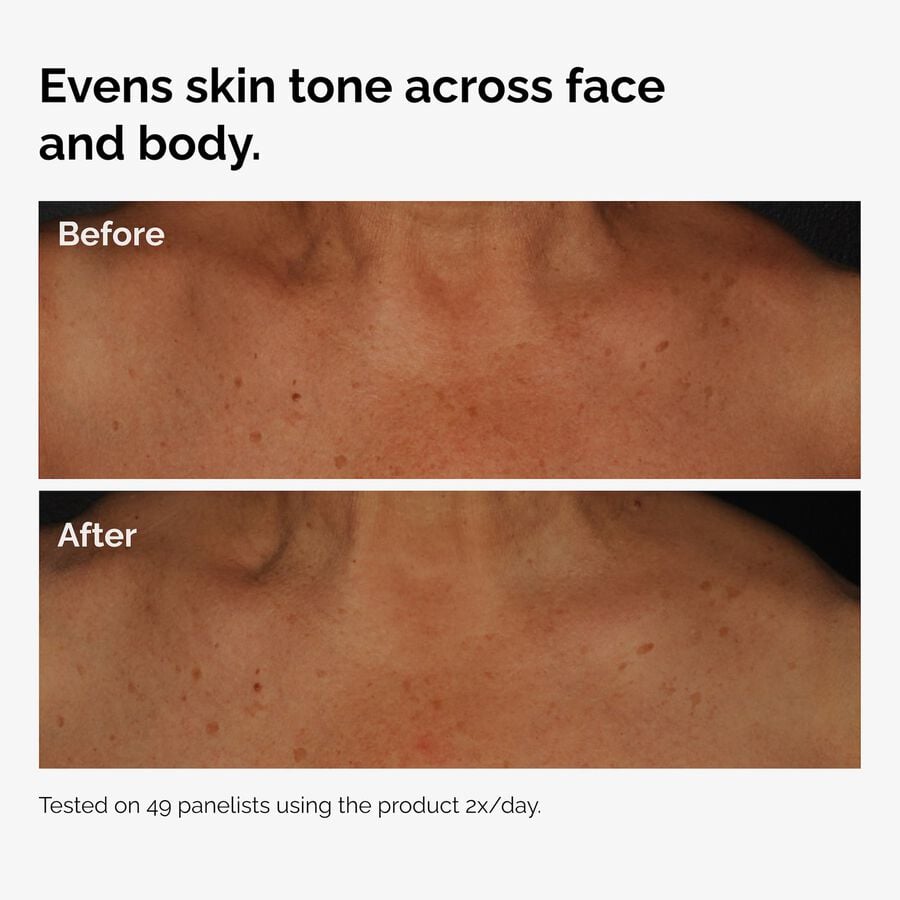 the-body-care-collection-r7 ord-niacinamide-face-body-serum-before-after-even-tone-graphic.jpg